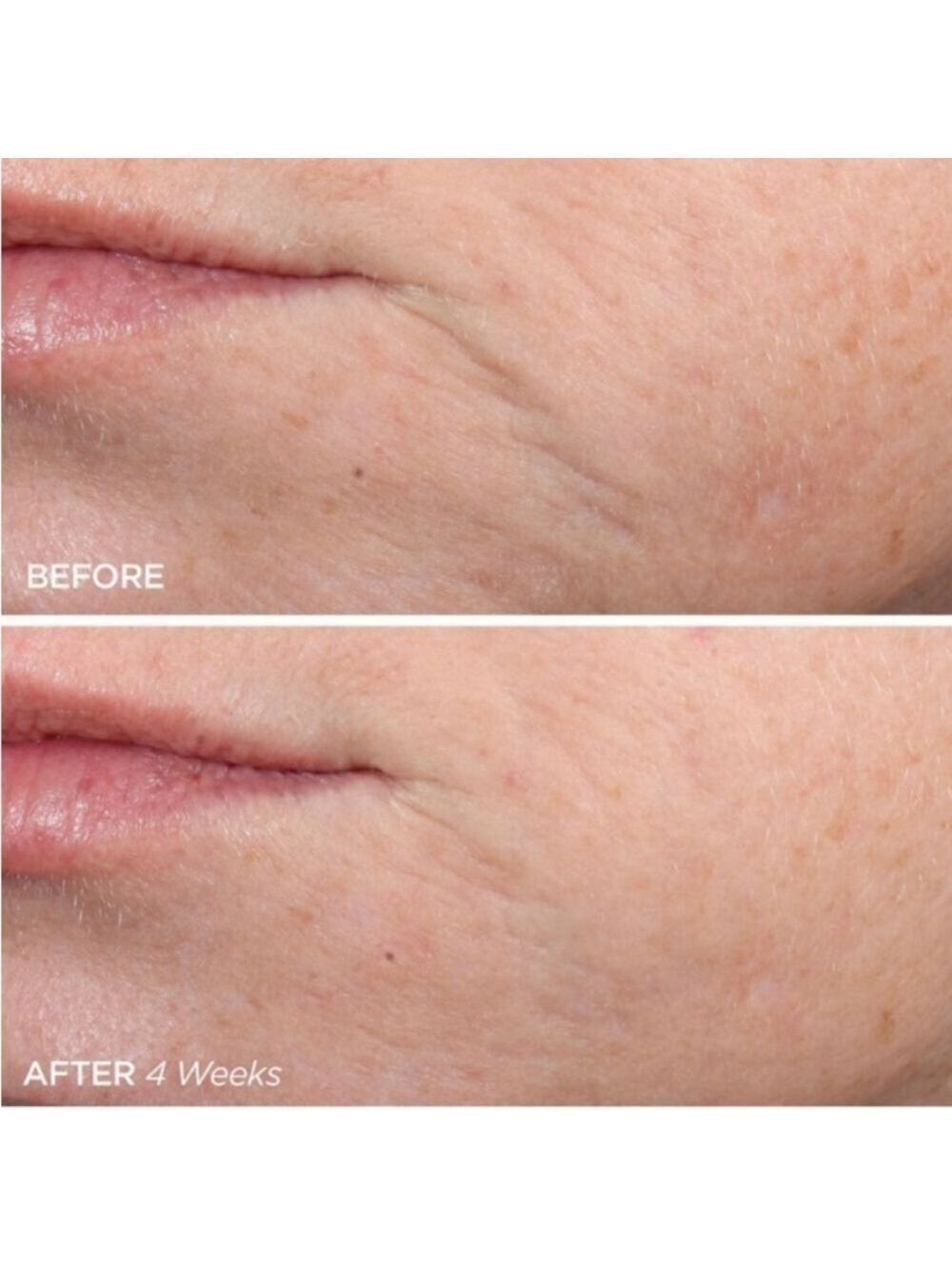BeautyBio ZenBubble Gel Facial Cream Moisturizer - Picture 3 of 13